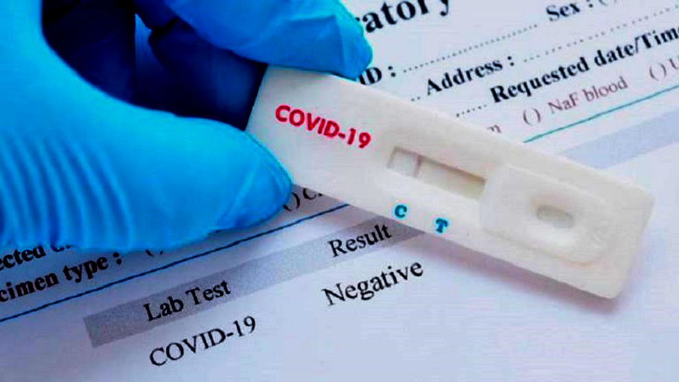 El CeCip compró 60 test rápidos que podrán adquirir sus asociados