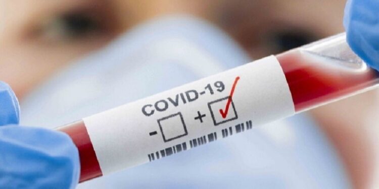 Anticipo placa del día: este viernes hubo 15 positivos en testeos de AG en Las Varillas