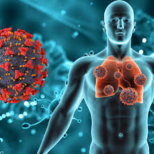 Precisiones sobre casos sospechosos de tuberculosis